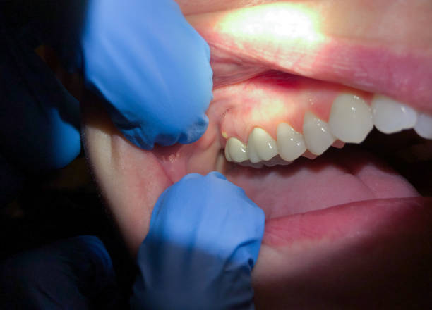 Best Orthodontic Emergency Dentist in Waxahachie, TX