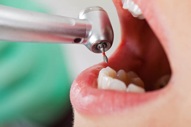 Best Emergency Dental Services for Seniors in Waxahachie, TX